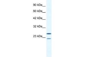 WB Suggested Anti-TRIM14 Antibody Titration:  0.