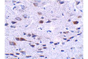Image no. 3 for anti-Protein Aurora Borealis (BORA) (C-Term) antibody (ABIN6656971)