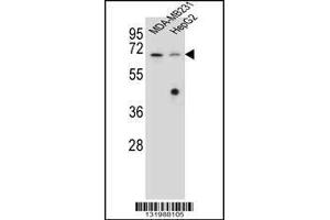 Image no. 1 for anti-Glomulin, FKBP Associated Protein (GLMN) (AA 498-525), (C-Term) antibody (ABIN655986)