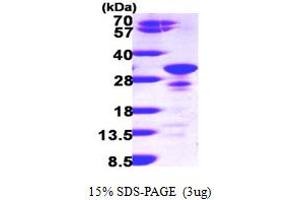 Image no. 1 for Secretogranin V (7B2 Protein) (SCG5) (AA 27-212) protein (His tag) (ABIN667198)
