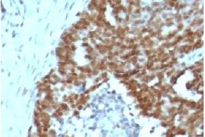 Immunohistochemistry (Formalin-fixed Paraffin-embedded Sections) (IHC (fp)) image for anti-Nucleolin (NCL) antibody (ABIN3025709)