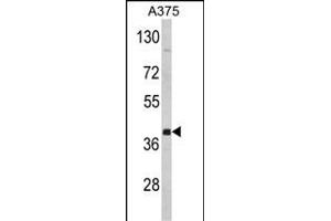 FNTA anticorps  (C-Term)