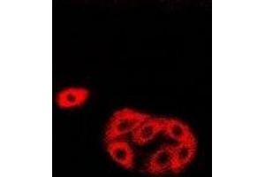 Image no. 1 for anti-Hyaluronan and Proteoglycan Link Protein 1 (HAPLN1) antibody (ABIN3198109)