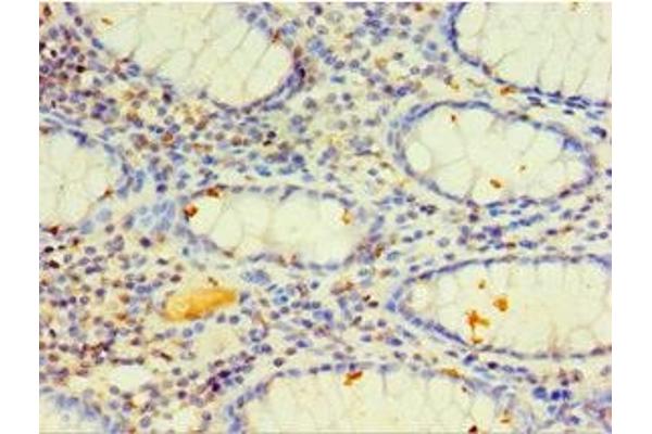 CYP4F12 anticorps  (AA 265-524)