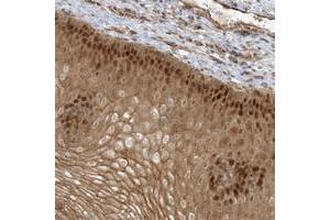Image no. 1 for anti-Nuclear ssembly factor 1 ribonucleoprotein (NAF1) antibody (ABIN5584170)