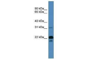 Image no. 1 for anti-Brain Abundant, Membrane Attached Signal Protein 1 (BASP1) (N-Term) antibody (ABIN929392)
