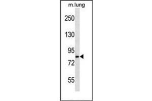 Image no. 1 for anti-Leucine Rich Repeat and Sterile alpha Motif Containing 1 (LRSAM1) (AA 1-30), (N-Term) antibody (ABIN953239)