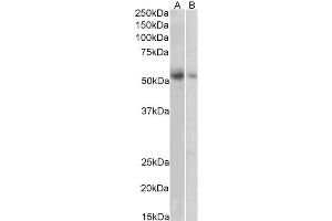 Image no. 5 for anti-Solute Carrier Family 18 (Vesicular Monoamine Transporter), Member 2 (SLC18A2) (C-Term) antibody (ABIN570915)
