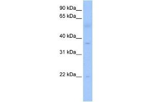 anti-RNA (Guanine-9-) Methyltransferase Domain Containing 3 (RG9MTD3) antibody
