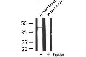 Image no. 1 for anti-Polymerase I and Transcript Release Factor (PTRF) (Internal Region) antibody (ABIN6264525)