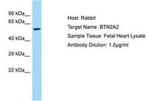 Image no. 1 for anti-butyrophilin, Subfamily 2, Member A2 (BTN2A2) (AA 64-113) antibody (ABIN6750158)