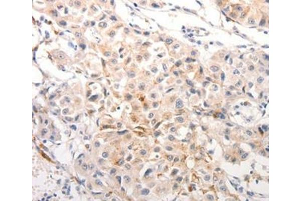 Keratin 6B antibody  (Internal Region)