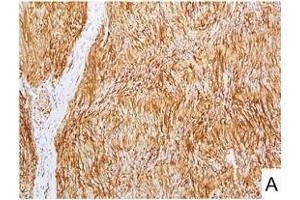 Image no. 6 for anti-L1 Cell Adhesion Molecule (L1CAM) (AA 1-1120) antibody (ABIN1995799)