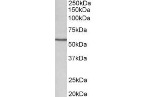 Image no. 2 for anti-Cytochrome P450, Family 1, Subfamily A, Polypeptide 1 (CYP1A1) (Internal Region) antibody (ABIN870663)