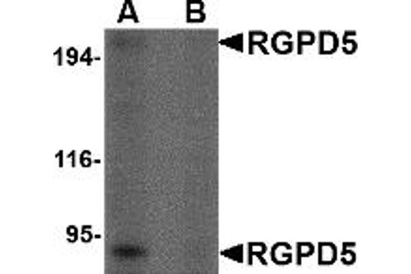 RGPD5 antibody  (Middle Region)