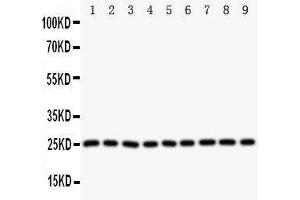 Image no. 1 for anti-Superoxide Dismutase 2, Mitochondrial (SOD2) (AA 45-62), (N-Term) antibody (ABIN3044165)