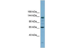 WB Suggested Anti-IARS Antibody Titration: 0.