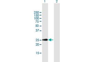 Image no. 1 for anti-C-Type Lectin Domain Family 2, Member D (CLEC2D) (AA 1-191) antibody (ABIN949235)