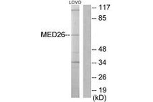 Image no. 1 for anti-Mediator Complex Subunit 26 (MED26) (AA 1-50) antibody (ABIN1533563)