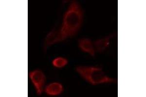 Image no. 3 for anti-Carboxylesterase 2 (CES2) (N-Term) antibody (ABIN6266331)