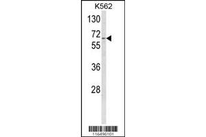 Image no. 1 for anti-Cytochrome P450, Family 4, Subfamily F, Polypeptide 3 (CYP4F3) antibody (ABIN2158464)