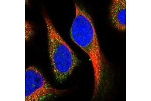 Image no. 2 for anti-Potassium Voltage-Gated Channel, Subfamily G, Member 1 (KCNG1) antibody (ABIN5581606)