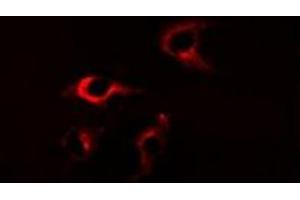 Image no. 2 for anti-FK506 Binding Protein 8, 38kDa (FKBP8) (full length) antibody (ABIN6043452)