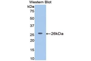 Image no. 1 for anti-Meningioma Expressed Antigen 5 (Hyaluronidase) (MGEA5) (AA 19-222) antibody (ABIN1172151)