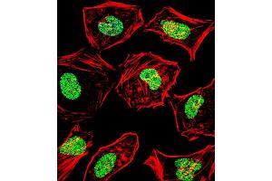 Image no. 1 for anti-Heart and Neural Crest Derivatives Expressed 2 (HAND2) (AA 81-110) antibody (ABIN1538642)