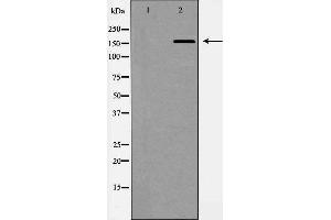 Image no. 1 for anti-ATP-Binding Cassette, Sub-Family C (CFTR/MRP), Member 1 (ABCC1) (N-Term) antibody (ABIN6266183)