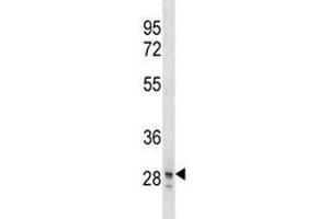 Image no. 2 for anti-Snail Homolog 3 (SNAI3) (AA 1-29) antibody (ABIN3029022)