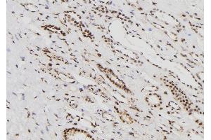 Image no. 1 for anti-Male Germ Cell-Associated Kinase (MAK) (pThr1579) antibody (ABIN6269927)