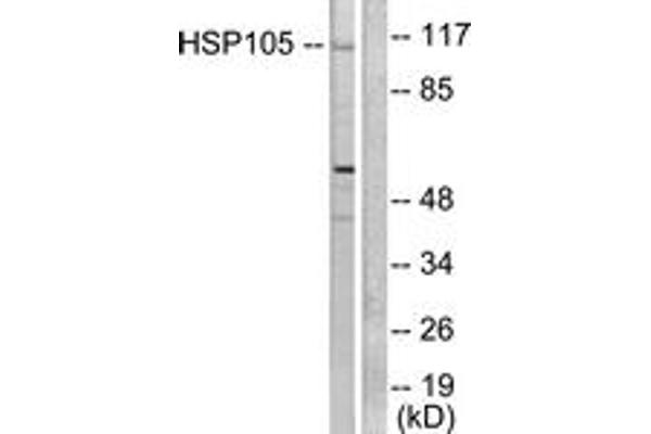 anti-Heat Shock 105kDa/110kDa Protein 1 (HSPH1) (AA 791-840) antibody