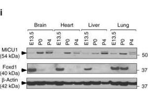 MICU1 is transcriptionally regulated by Foxd1 under hypoxia.