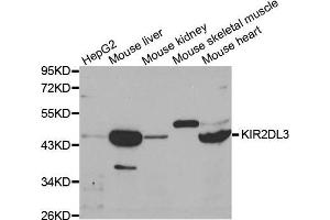 Image no. 1 for anti-Killer Cell Immunoglobulin-Like Receptor, Two Domains, Long Cytoplasmic Tail, 3 (KIR2DL3) antibody (ABIN3022411)