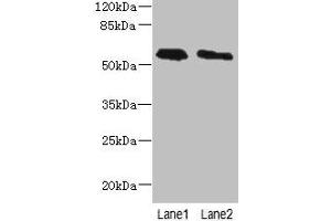Phospholipase D4 antibody  (AA 52-506)