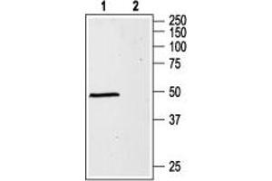 GABRA1 antibody  (Extracellular, N-Term)