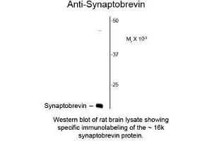 Image no. 1 for anti-Synaptobrevin (VAMP) antibody (ABIN956753)