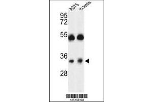 Image no. 2 for anti-ORAI Calcium Release-Activated Calcium Modulator 1 (ORAI1) (AA 145-173) antibody (ABIN653318)