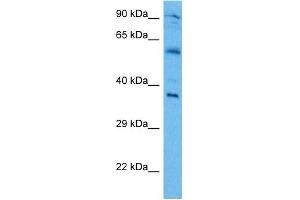 Image no. 2 for anti-Interferon Regulatory Factor 1 (IRF1) (Middle Region) antibody (ABIN2779861)