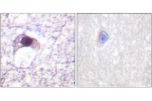 Image no. 2 for anti-E2F Transcription Factor 6 (E2F6) (AA 141-190) antibody (ABIN1533260)