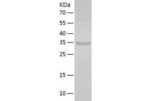 Ubiquitin Protein (Ubiquitin) (AA 1-299) (His tag)