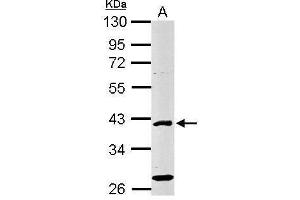 Image no. 2 for anti-E2F Transcription Factor 1 (E2F1) (Internal Region) antibody (ABIN2856879)