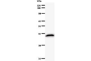 Image no. 1 for anti-Tax1 (Human T-Cell Leukemia Virus Type I) Binding Protein 1 (TAX1BP1) antibody (ABIN931085)