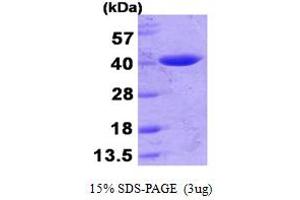 Image no. 1 for Lactamase, beta (LACTB) (AA 20-377) protein (His tag) (ABIN667372)