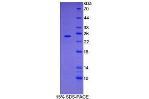 Image no. 1 for Signal Transducer and Activator of Transcription 3 (Acute-Phase Response Factor) (STAT3) (AA 346-552) protein (His tag) (ABIN6238627)