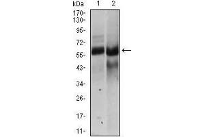 Image no. 3 for anti-Hyaluronan Synthase 2 (HAS2) (AA 67-170) antibody (ABIN1098124)
