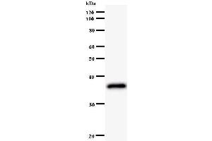 Image no. 2 for anti-LIM Homeobox 2 (LHX2) antibody (ABIN930948)