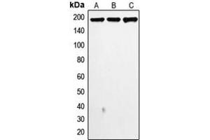 Image no. 3 for anti-Topoisomerase (DNA) II alpha 170kDa (TOP2A) (N-Term) antibody (ABIN2707764)