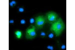 Image no. 4 for anti-Mitogen-Activated Protein Kinase 12 (MAPK12) antibody (ABIN1499302)